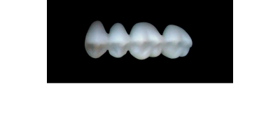 Cod.S4UPPER LEFT : 15x  posterior solid (not hollow) wax bridges, X-SMALL, (24-27) , with precarved occlusion to Cod.S4LOWER LEFT,and compatible to Cod.E4UPPER LEFT (hollow), (24-27)